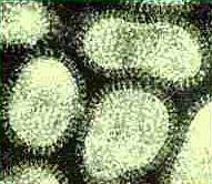Virus dell'influenza A al microscopio elettronico